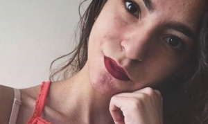 Lucila recibió el trasplante bipulmonar que esperaba