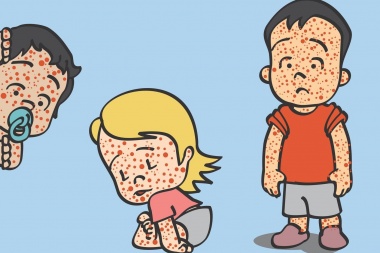 Brindan recomendaciones ante la circulación del virus de sarampión en países de la región
