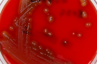 Streptococcus pyogenes: 5 claves que tenés que saber