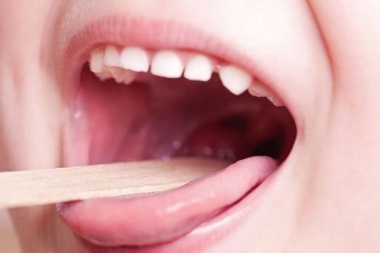 Streptococcus: Salud pide tranquilidad y recuerda que no hay brote epidemiológico