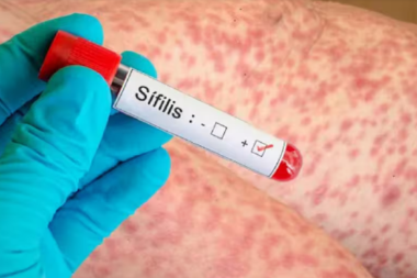 Alerta por el aumento de sífilis: crecieron un 54% respecto al año pasado en Tierra del Fuego