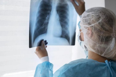 Preocupa el aumento de casos de tuberculosis en Argentina: ya superaron los 17.000 de 2025